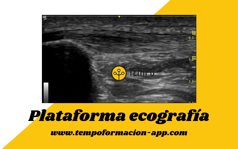 5. Tendon rotuliano ecografia tempo formacion.png